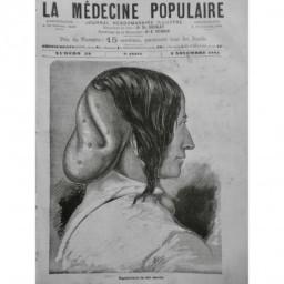 1881 MEDECINE ELEPHANTIASIS CUIR CHEVELU