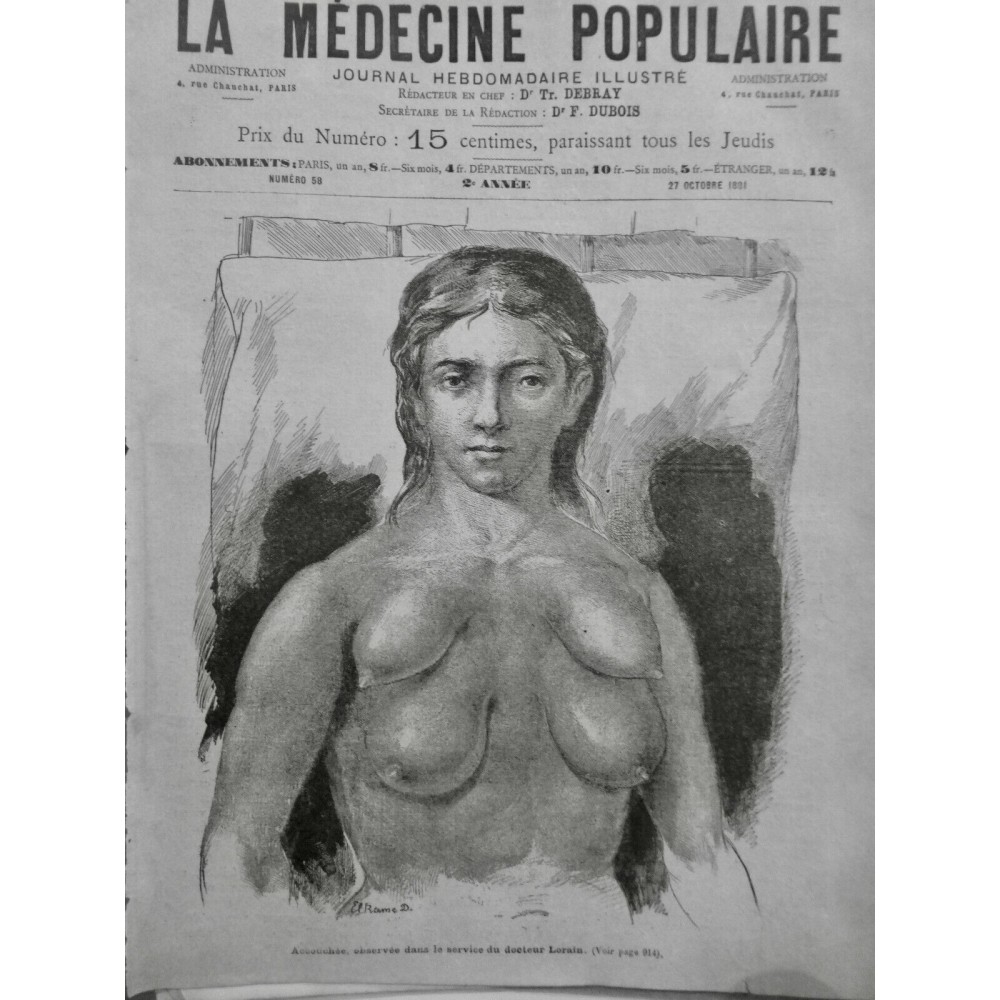 1881 MEDECINE MAMELLES SUPPLEMENTAIRES ACCOUCHEE DR LORAIN LAIT