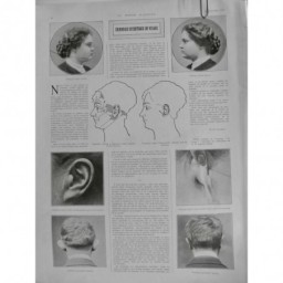 1921 MI CHIRURGIE ESTHETIQUE VISAGE NEZ OREILLE AUTOPLASTIE ELECTROLYSE LAGARDE