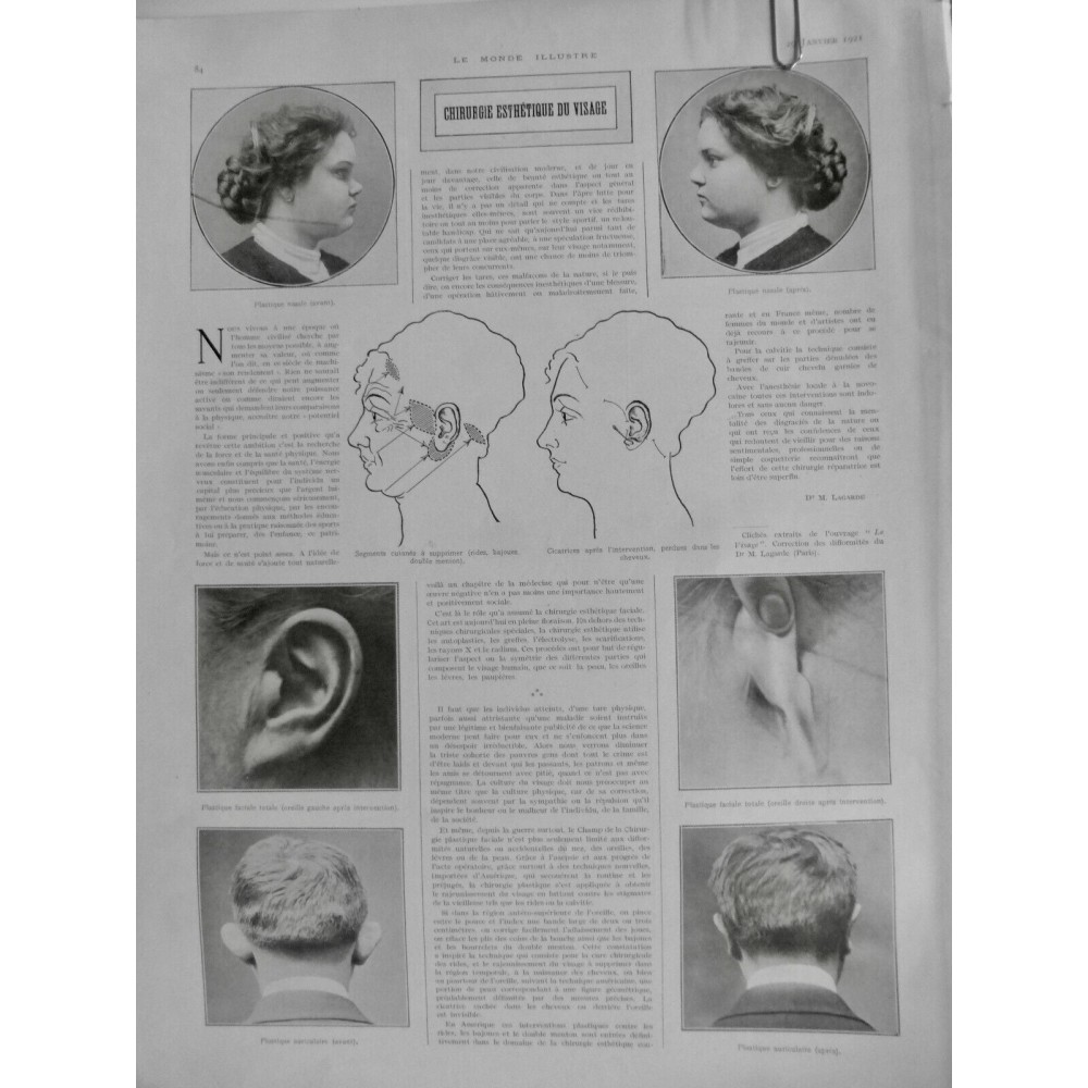 1921 MI CHIRURGIE ESTHETIQUE VISAGE NEZ OREILLE AUTOPLASTIE ELECTROLYSE LAGARDE